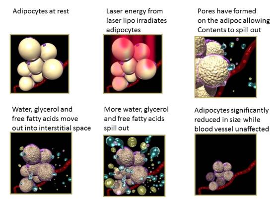 lipo laser 原理图.jpg