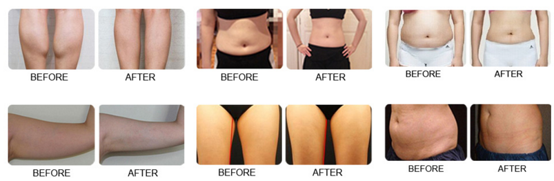 before after.png